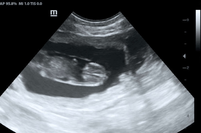 Camada 1 - Imagen 2 Camada 1 - Imagen 2